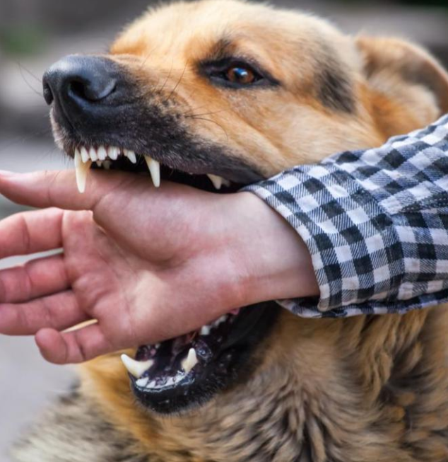 Photo of a dog bite